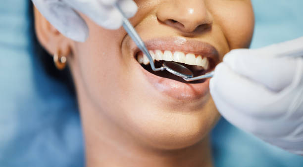 Best Emergency Wisdom Teeth Removal in St Augustine, FL